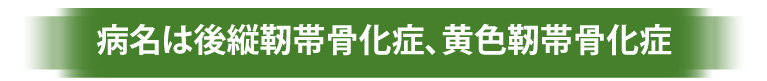 病名は後縦靭帯骨化症、黄色靭帯骨化症
